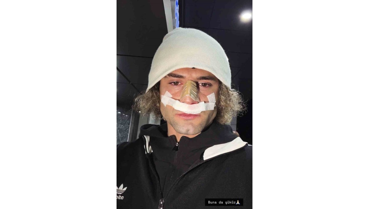 Elazığspor'da Fuat Bavuk'un burnu kırıldı