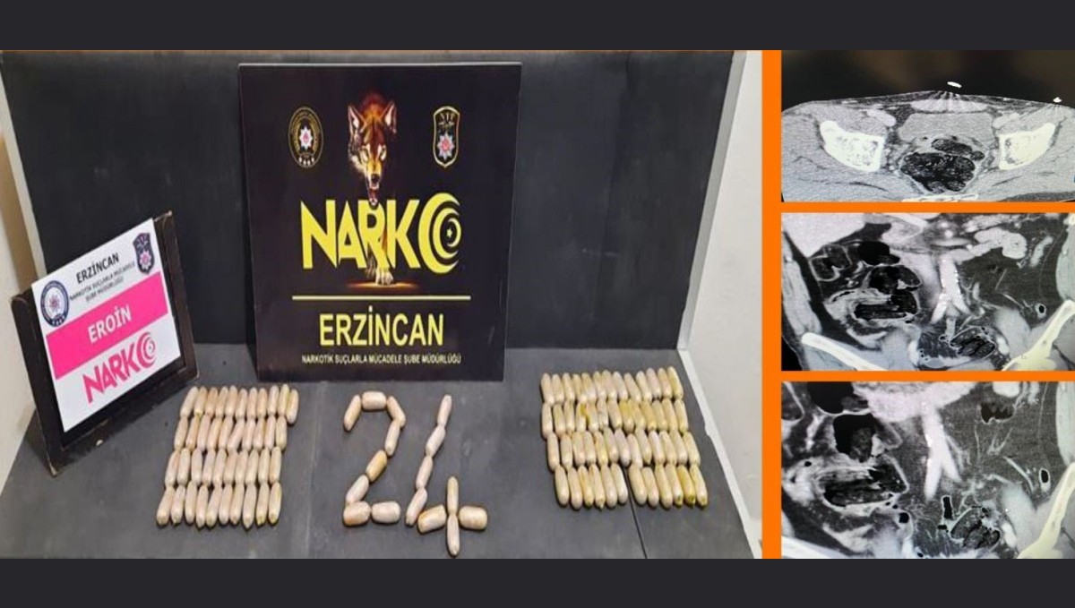 Erzincan polisinden çarpıcı operasyon: Midelerinde 109 ölüm kapsülü
