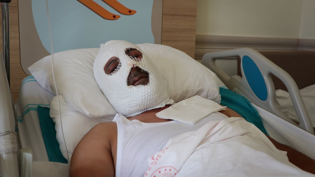 Erzurum'da doğal gaz borusunun alev almasıyla yaralanan işçinin tedavisi sürüyor