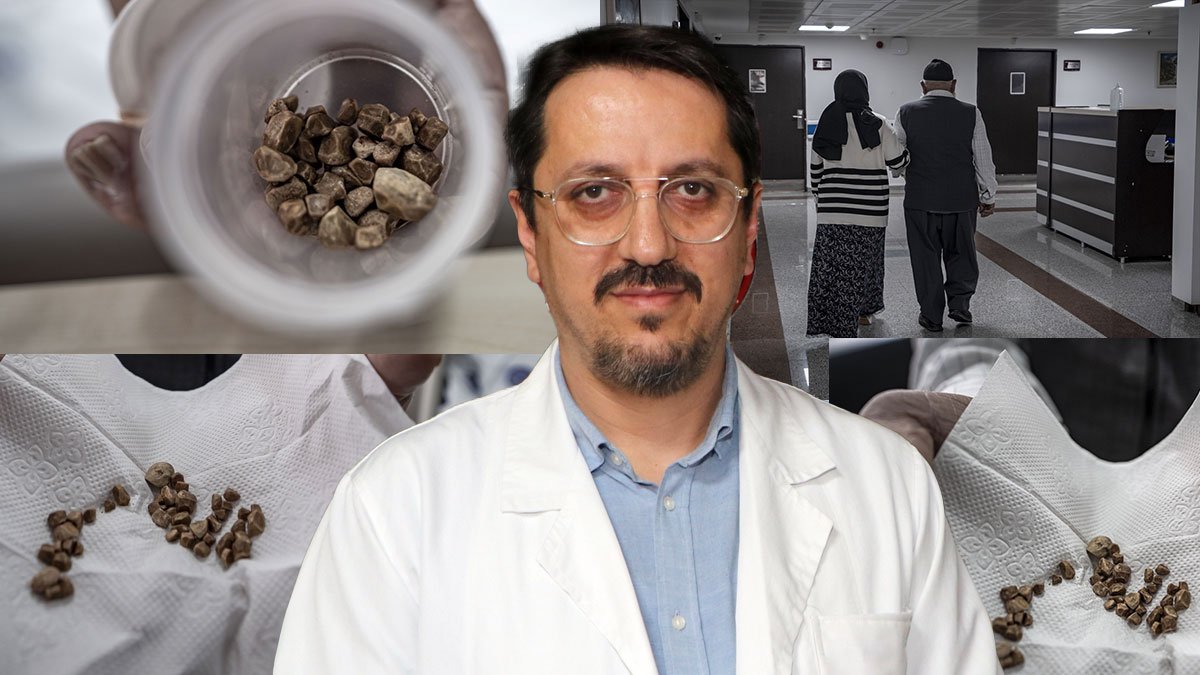 Erzurum'da sıra dışı operasyon! 31 yaşındaki kadının üreterinden 51 taş çıkarıldı