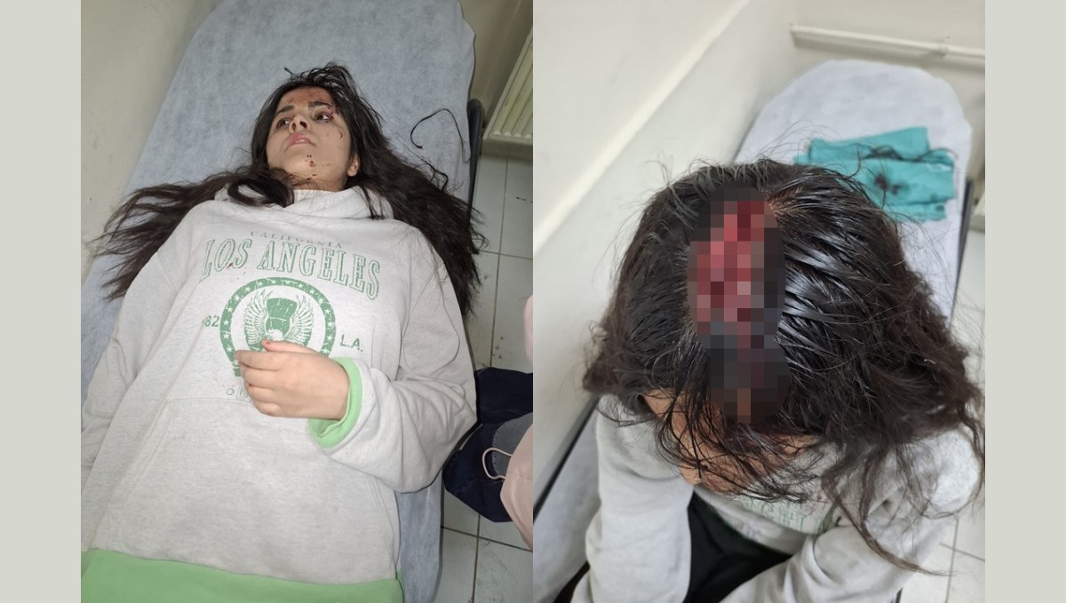 Hakkari'de başına buz kütlesi düşen genç kız yaralandı