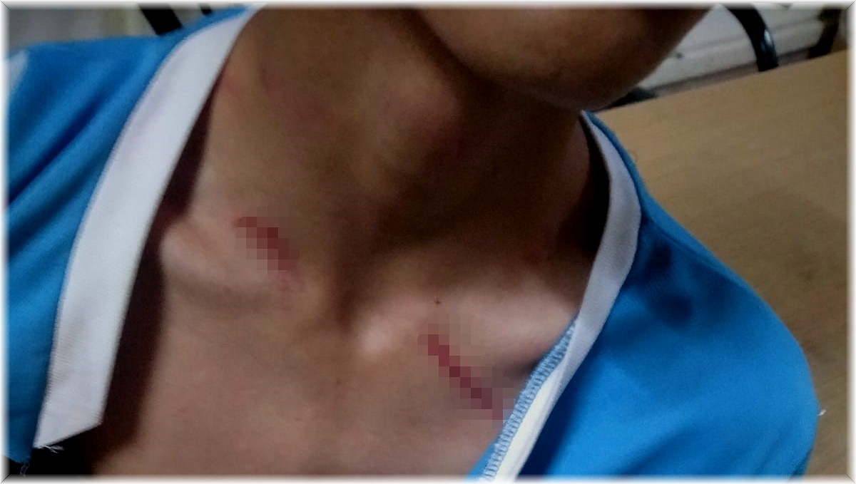 Hayvan otlatma meselesi kanlı bitti: 2 yaralı