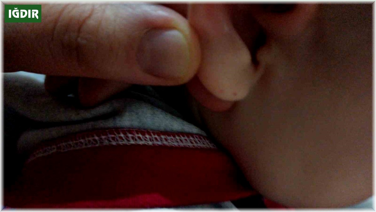 Iğdır'da eve giren yarasa, küçük iki çocuğun kulağını ısırdı