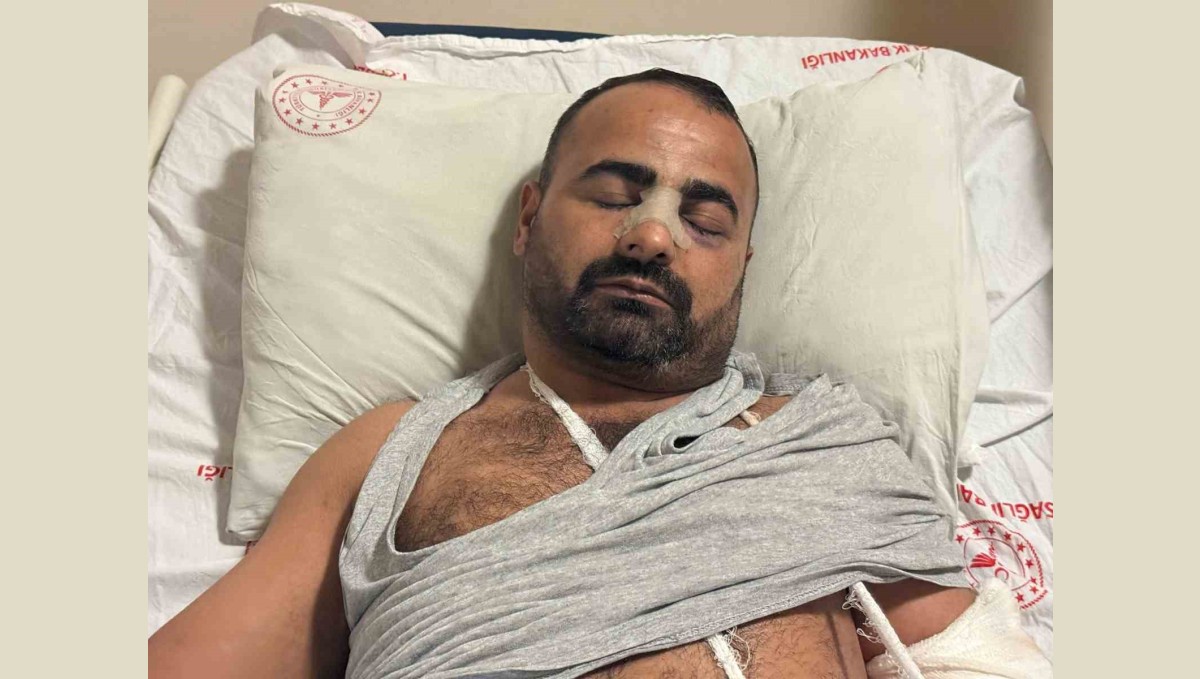 Iğdır'da sokak ortasında darp edilen Ahmet Sağınç konuştu: "Eski eşimin amcaoğlu ve aynı zamanda eşi olan kişi saldırdı