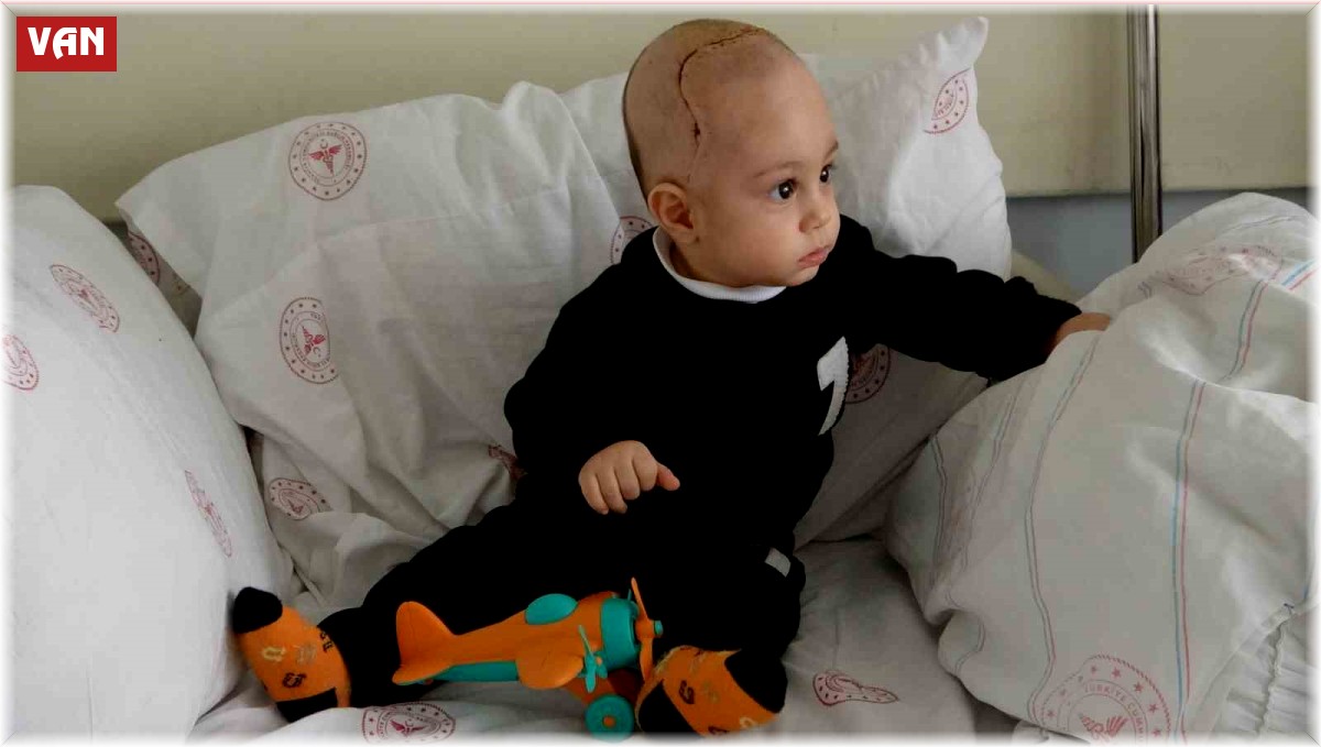 Kafatasında şekil bozukluğu olan 7 aylık bebek ameliyat edildi