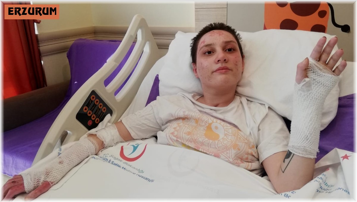 Kafe yangınında ağır yaralanan genç kız: 'Son 2 ayı hatırlamıyorum'