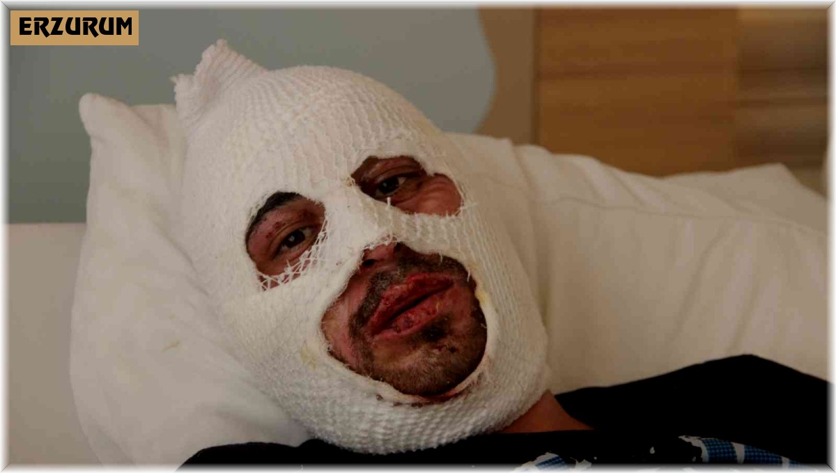 Kafe yangınında canını zor kurtardı