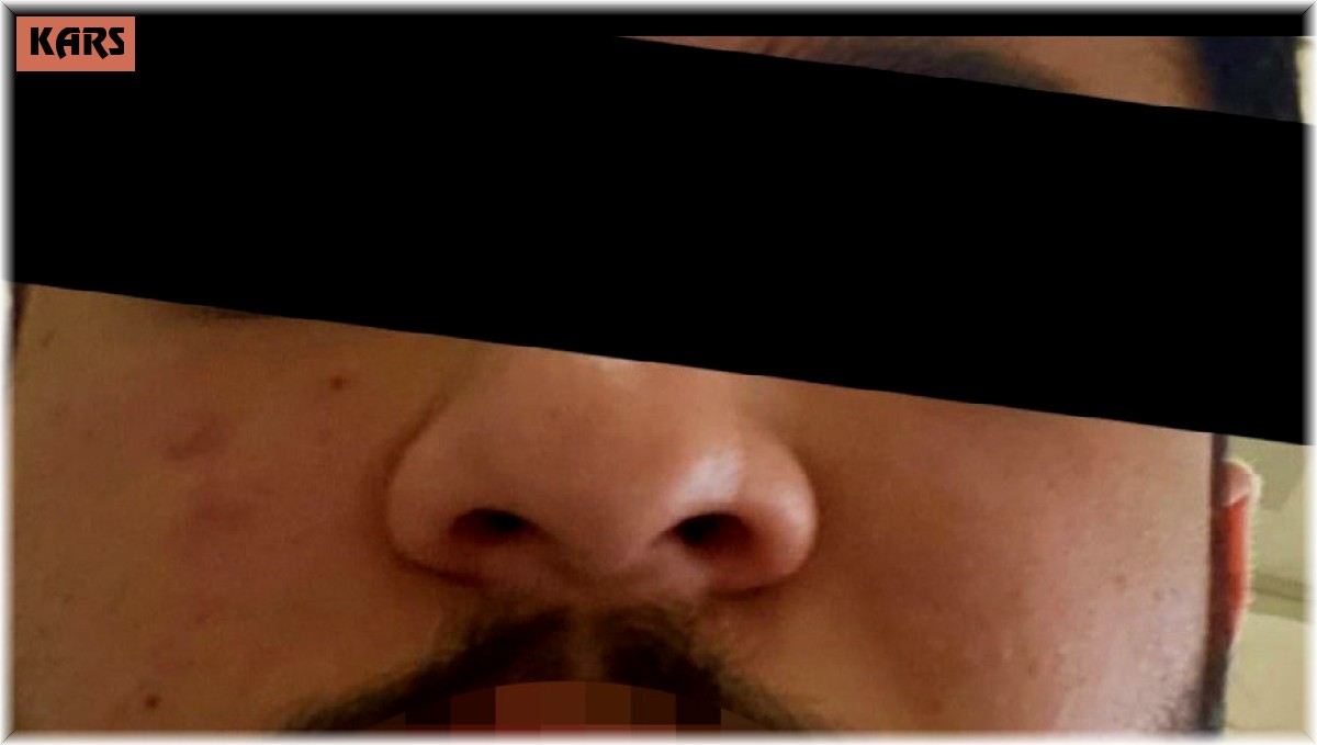 Kars'ta sağlık çalışanı darp edildi