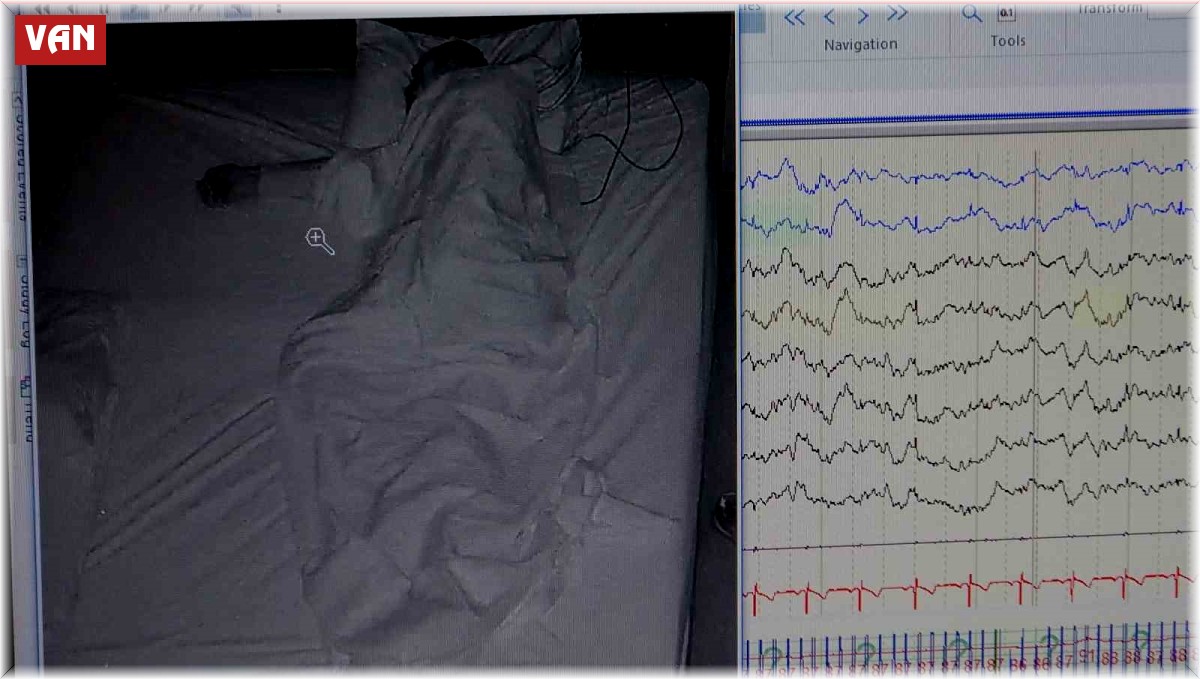 Klinik Nörofizyoloji Uzmanı Leba: "Uyku hastalığı kişinin ömrünü kısaltır"