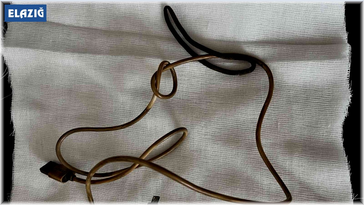 Kusma ve karın ağrısı şikayetiyle doktora giden çocuğun karnından telefon şarj kablosu çıktı