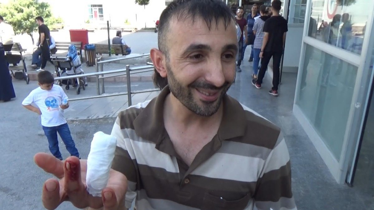 Malatya'da acemi kasaplar hastanelik oldu