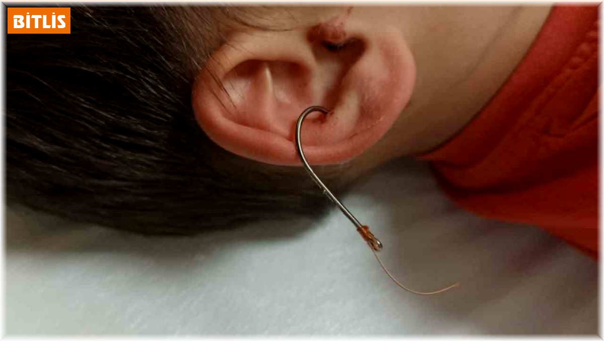 Oltayla oynarken kulağına olta kancası saplandı