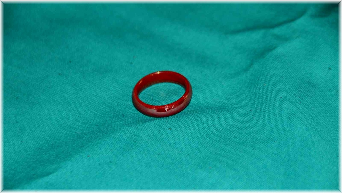 Oyun oynarken yerdeki yüzüğü yutan 3 yaşındaki çocuk ölümden döndü