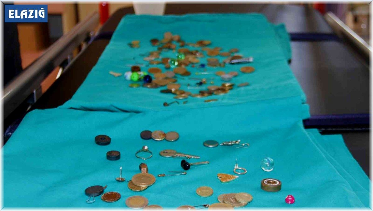 Para, pul, iğne, yüzük: Bu midelerde ne ararsanız var