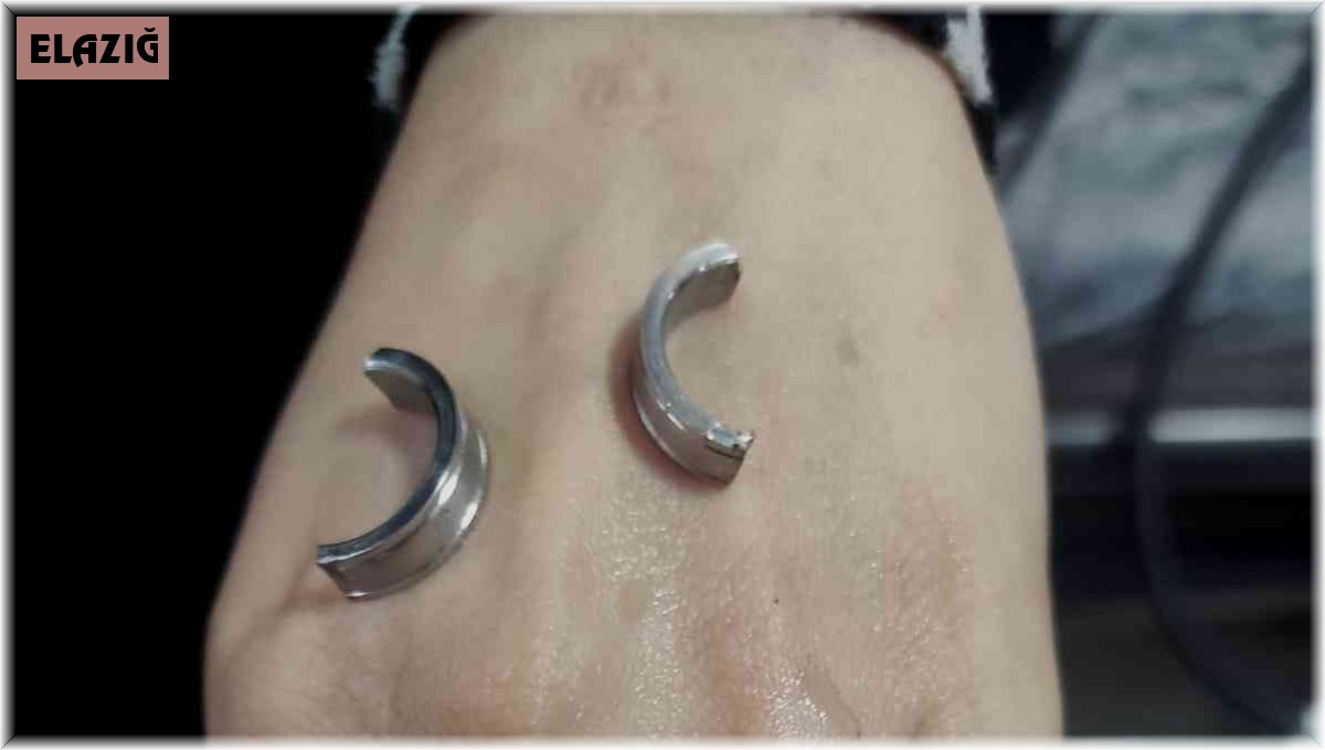 Parmağa sıkışan yüzüğü itfaiye ekipleri çıkardı