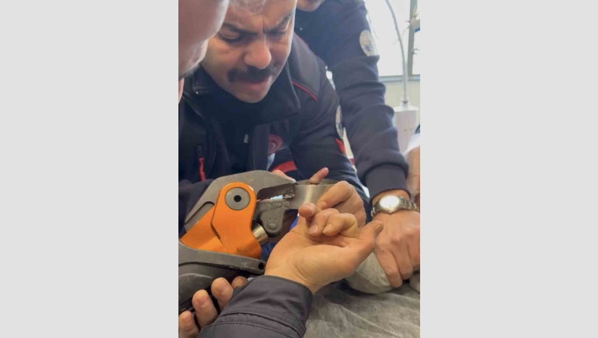 Parmağı çelik küllüğe sıkışan bebeğin imdadına itfaiye yetişti