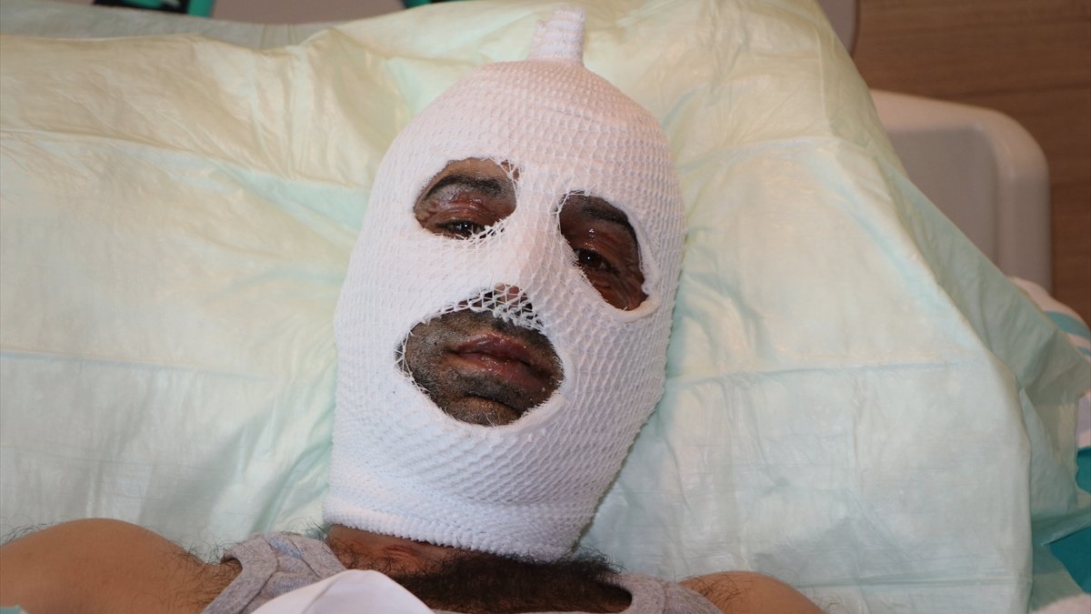 Piknik tüpünü yakarken parlama sonucu yaralanan esnafın Erzurum'da tedavisi sürüyor