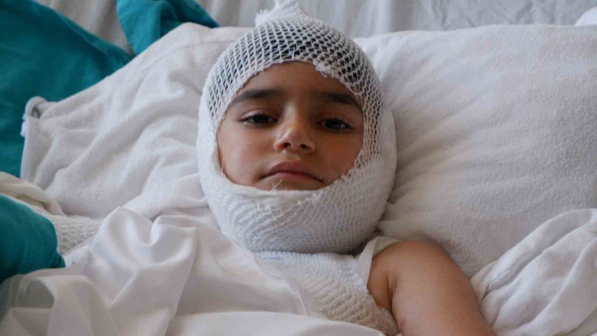 Pilav kazanına düşerek yanan Nahçıvanlı çocuk Erzurum'da tedavi ediliyor