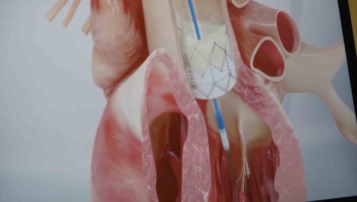 Prof. Dr. Pekdemir: "Gençlerde ani ölümlerin yüzde 90'ı genetik nedenlerden kaynaklanıyor"