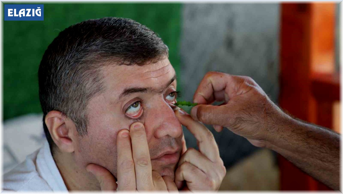 Randevu almayanları geri gönderiyor: Elazığ'da kırlangıç otu ile göz hastalıklarına umut