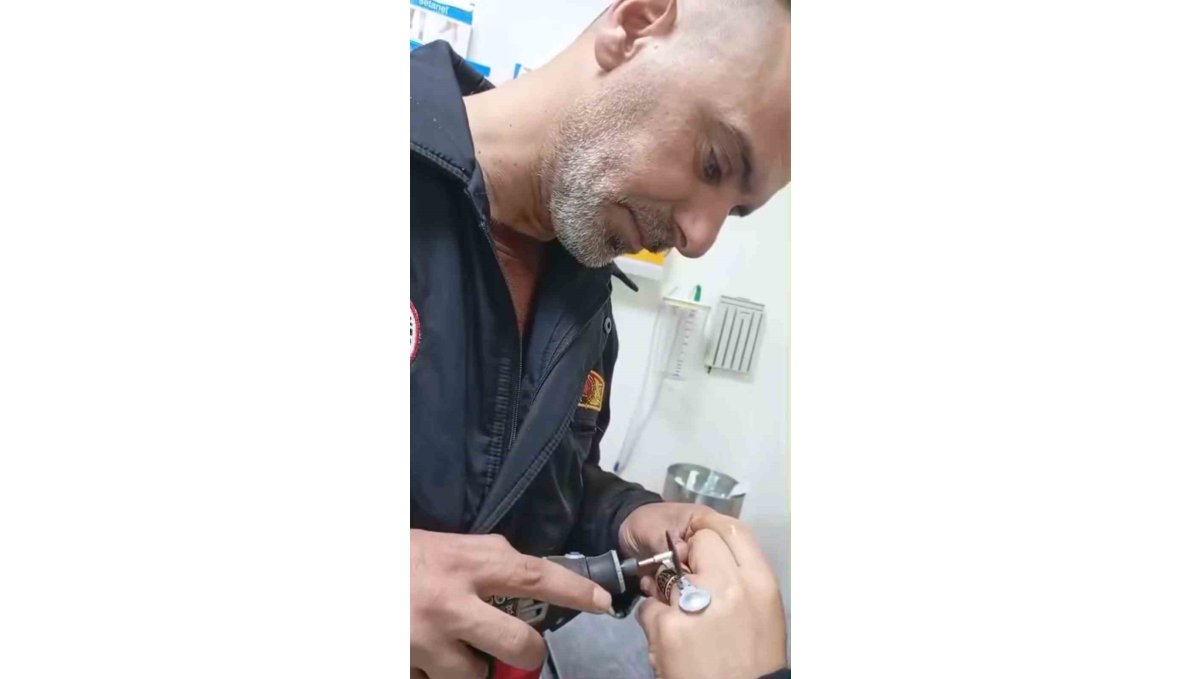 Sıkışan yüzük itfaiye ekiplerince çıkarıldı