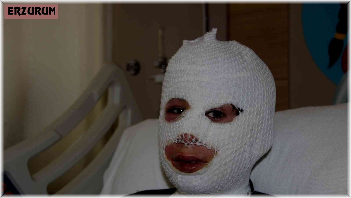 Sobada ayaklarını ısıtırken kendini yaktı