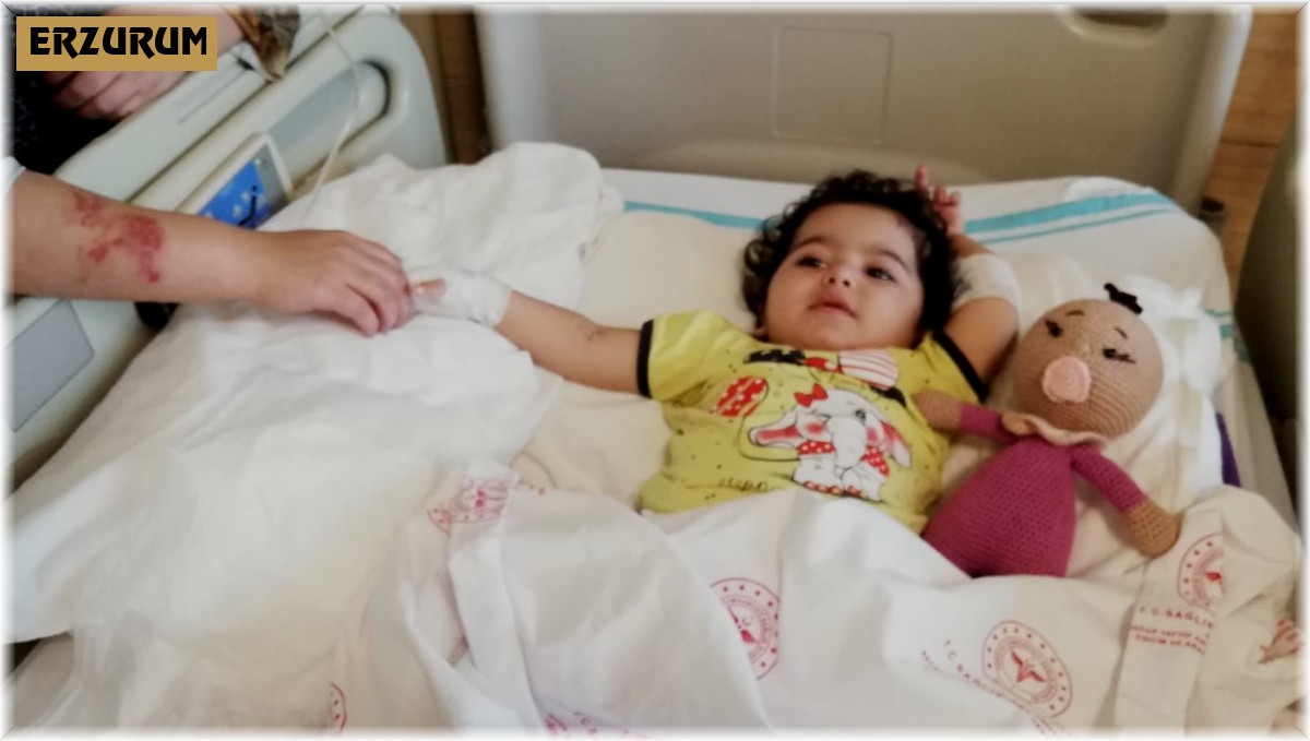 Sobadan devrilen çaydanlık minik Eslem'i yaktı