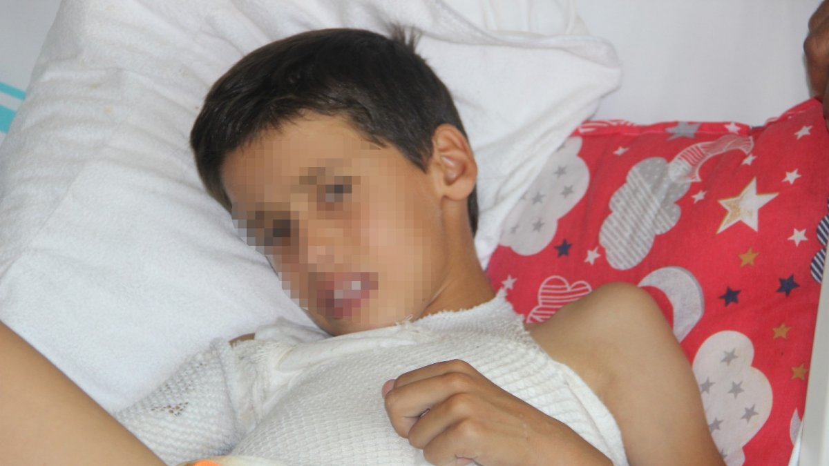 Sosyal medyadan görüp üzerine kolonya döktüğü ikizini yaktı