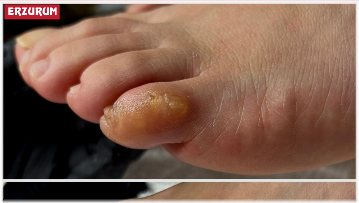 Tırnak bakımına dikkat