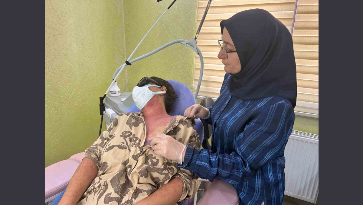 Van'da 'beyazlatıcı krem' faciası: 4 kişi hastanelik oldu