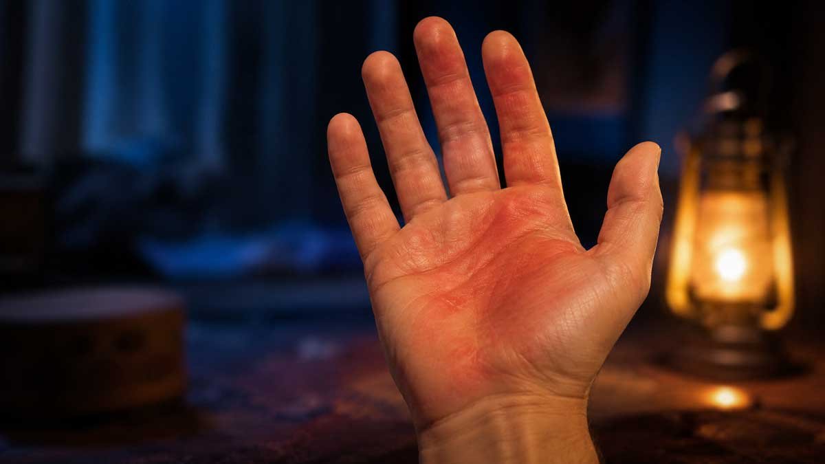 Rüyada Elinin Yandığını Görmek: Anlamı ve Yorumu