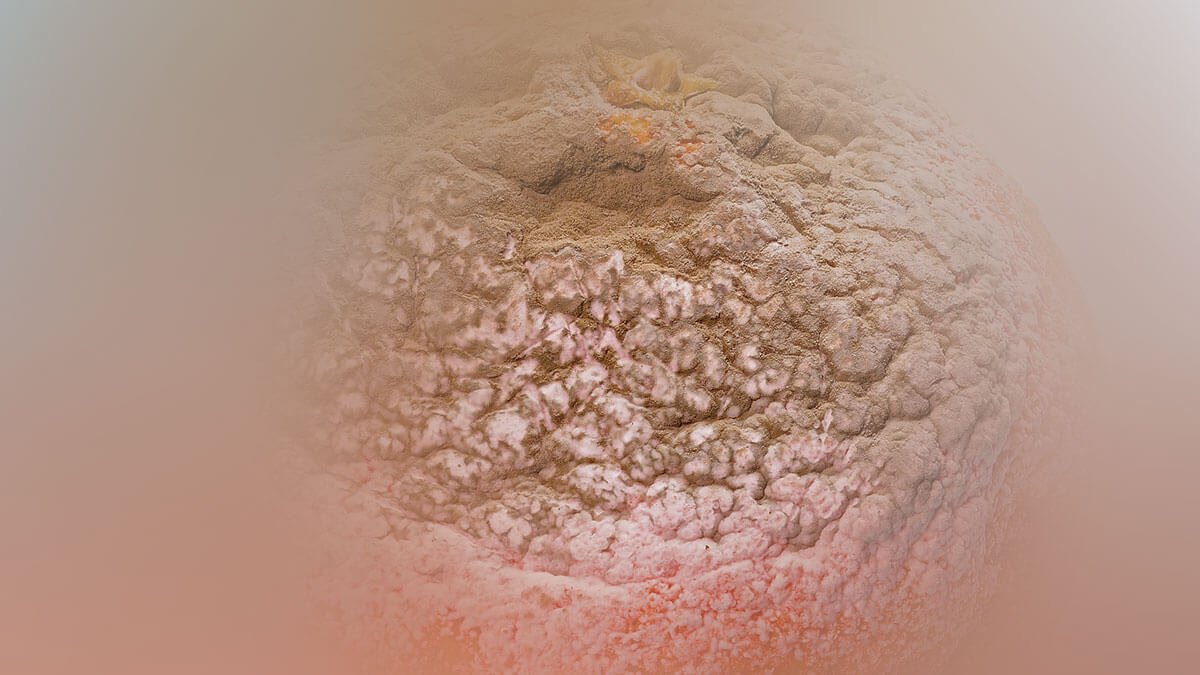 Rüyada Küf Görmek: Anlamı ve Yorumu