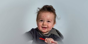 Rüyada Hasta Bebek Görmek