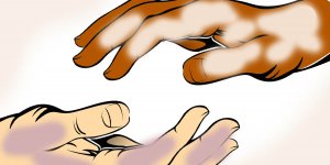 Rüyada Abraş Görmek