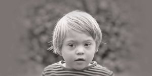 Rüyada Down Sendromlu Birini Görmek