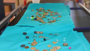 Para, pul, iğne, yüzük: Bu midelerde ne ararsanız var