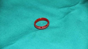 Oyun oynarken yerdeki yüzüğü yutan 3 yaşındaki çocuk ölümden döndü