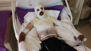 Elektrik akımına kapılan sürüdeki koyunları kurtarırken ölümden döndü