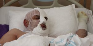 Tıkalı lavaboyu kimyasal ürünle açma denemesi hastanelik etti