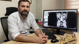 Elazığ'da 13 aylık bebeğin böbreğindeki 5 santimetrelik taş ameliyatla çıkarıldı