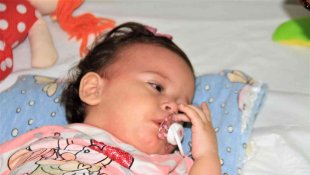 13 aylık bebeğin böbreğinden çıkan taş şaşırttı