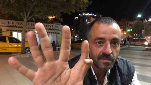 Elazığ'da 11 parmaklı adam görenleri hayrete düşürüyor