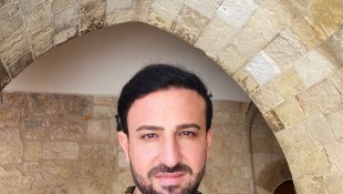 Uzm. estetisyen Zübeyir Dalmış: "Epilasyondan sonra en az on iki saat boyunca herhangi bir krem, losyon veya makyaj kullanmamalısınız"