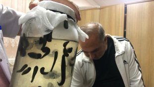 Hastalar 5 bin yıllık tedavi yöntemleriyle şifa buluyor