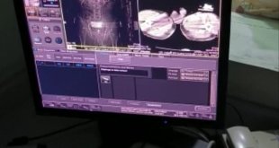 Ağrı'da iç organlarından uyuşturucu çıkarılan 4 zanlı tutuklandı