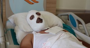 Erzurum'da doğal gaz borusunun alev almasıyla yaralanan işçinin tedavisi sürüyor