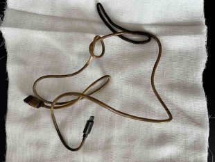 Kusma ve karın ağrısı şikayetiyle doktora giden çocuğun karnından telefon şarj kablosu çıktı