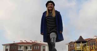 Sol bacağı olmadan dünyaya geldi, engelin engel olmadığını kanıtladı