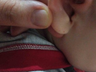 Iğdır'da eve giren yarasa, küçük iki çocuğun kulağını ısırdı