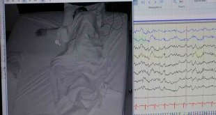 Klinik Nörofizyoloji Uzmanı Leba: "Uyku hastalığı kişinin ömrünü kısaltır"